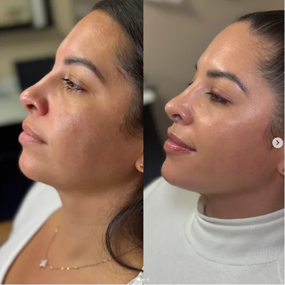 Med Spa Four in Long Beach and Orange Country Beauty By Jitka