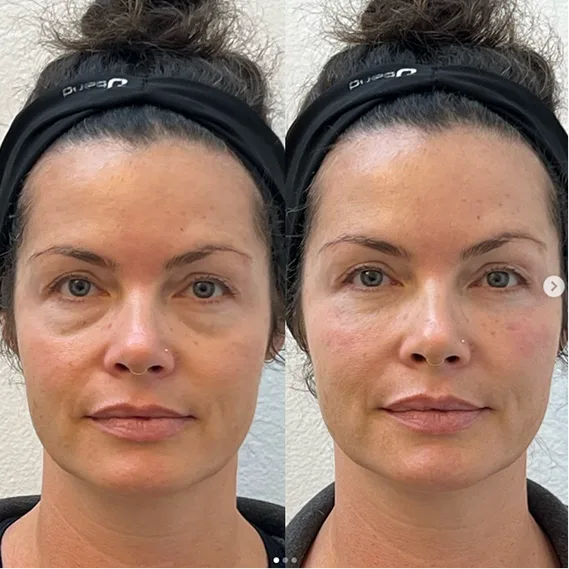 Med Spa One in Long Beach and Orange Country Beauty By Jitka