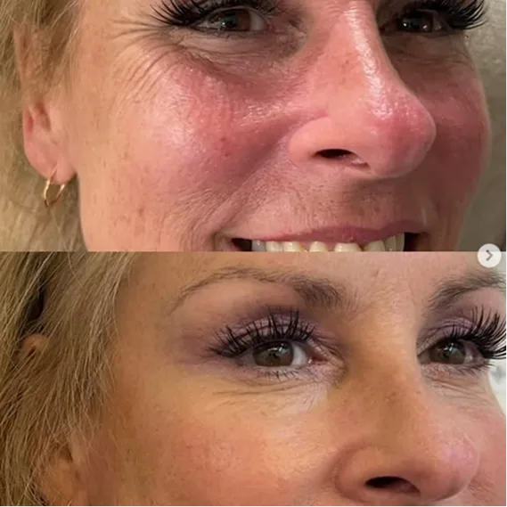 Med Spa Seven in Long Beach and Orange Country Beauty By Jitka