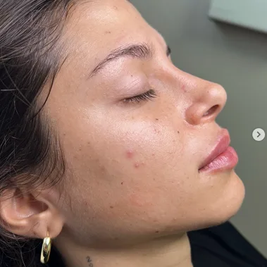 Med Spa Three in Long Beach and Orange Country Beauty By Jitka